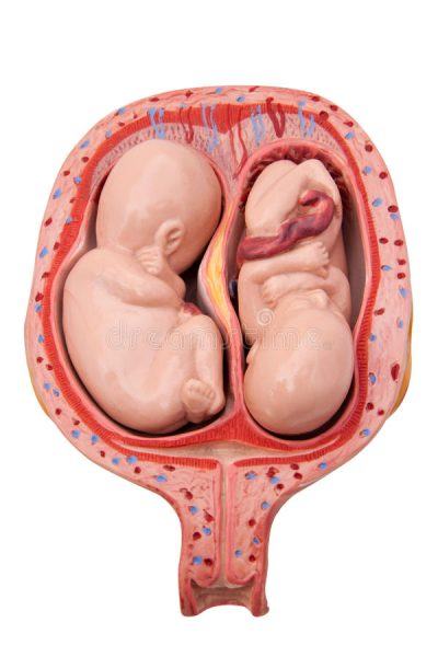 hình ảnh em bé trong bụng mẹ của cặp song sinh