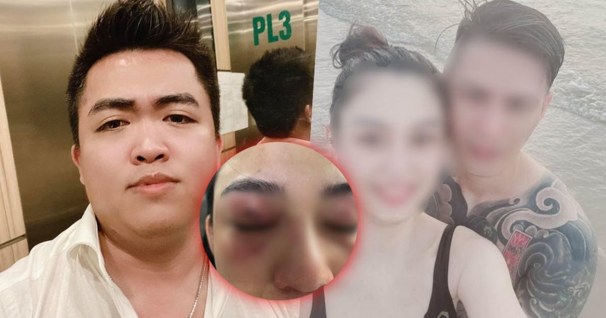 Khoe lột da mặt hot girl Trang Nemo khiến netizen chạy mất dép