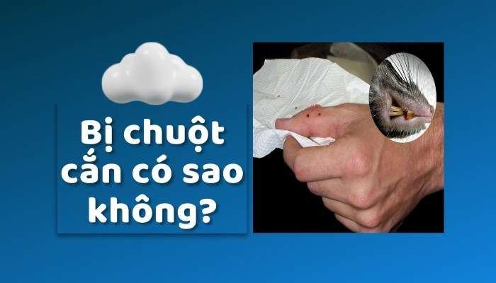 Bị chuột cắn có sao không? Làm gì khi bị chuột cắn?