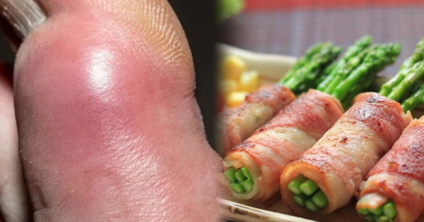 3 loại rau, 4 loại nước là “thủ phạm” gây bệnh gút: Đáng tiếc là nhiều người trong chúng ta đang làm sai