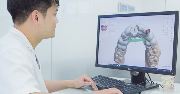 3 yếu tố làm nên sự thành công của công nghệ DCT