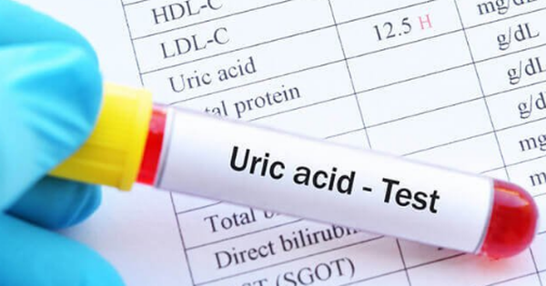 Ai có nguy cơ bị tăng acid uric máu?