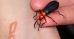 Ăn loại côn trùng được đồn thổi giúp tăng cường sinh lý, người đàn ông đái ra máu, suy thận cấp