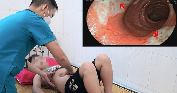Bé 9 tuổi ở Phú Thọ bị loét hành tá tràng do cha mẹ cho dùng thuốc hạ sốt sai cách