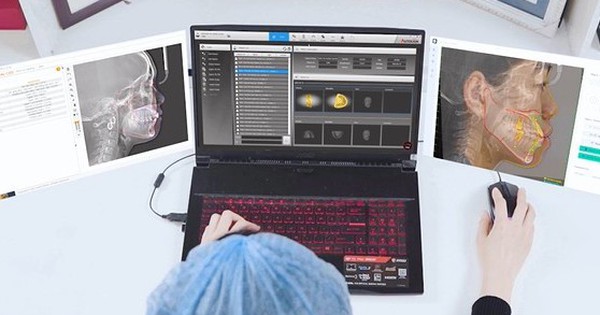 Các chiến lược mới trong việc giảm thiểu biến chứng niềng răng