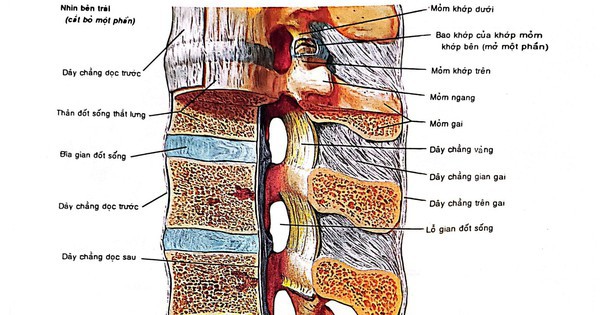 Các phương pháp trị thoát vị đĩa đệm