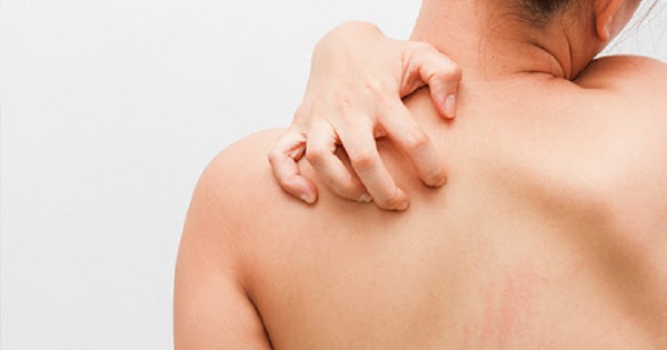 Làm gì để không bị ngứa và dị ứng da vào mùa đông, khi thời tiết lạnh và hanh khô