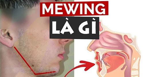 Mewing là gì? Cách luyện tập phương pháp Mewing hiệu quả