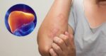 Mùa hè nắng nóng, khi nào nên thải độc gan, đây là 3 nhóm người cần cảnh giác