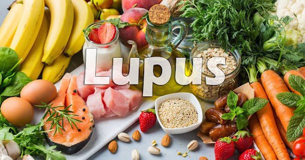 Người bệnh lupus ban đỏ nên ăn gì để kiểm soát tốt bệnh?