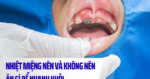 Nhiệt miệng nên ăn gì và kiêng gì để nhanh khỏi?