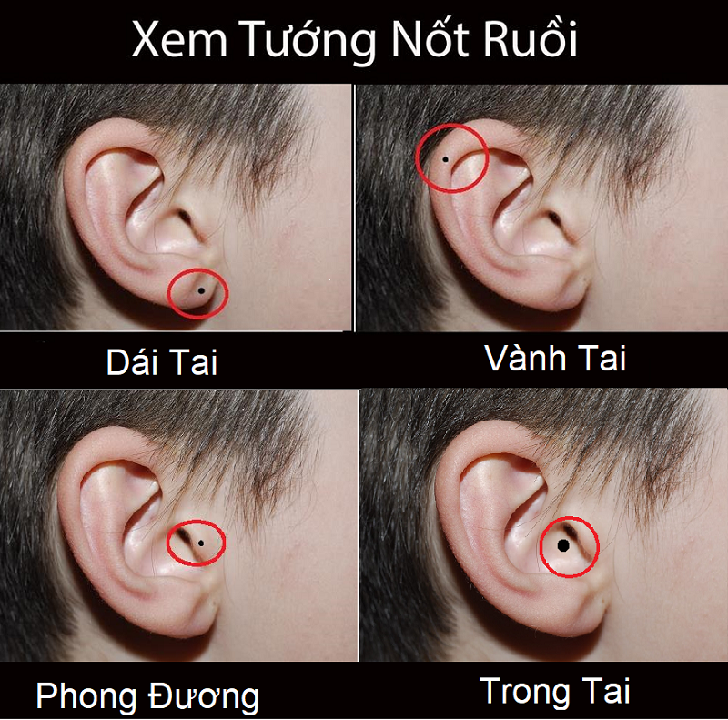 Giải mã ý nghĩa nốt ruồi ở tai phụ nữ và đàn ông