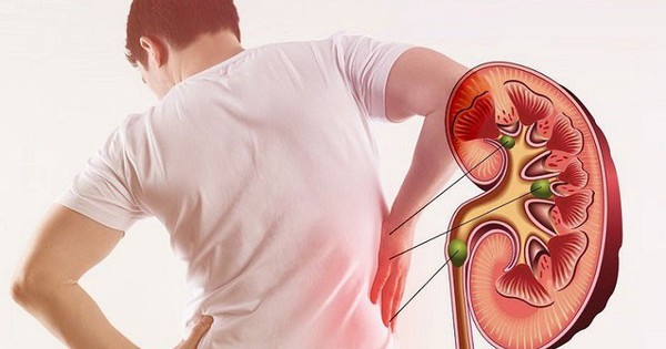 Thanh niên 20 tuổi bất ngờ phát hiện mắc hội chứng thận hư dù không có triệu chứng, đây là biến chứng đáng sợ nếu không điều trị đúng cách!