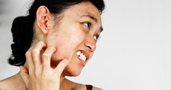 Từ ngứa da đến ung thư giai đoạn cuối chỉ 3 tháng, có dấu hiệu này trên da, cẩn thận khối u đã xâm lấn