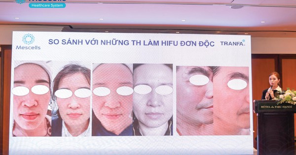 Workshop 2023 với chủ đề “Centerless Focused Ultrasound – Công nghệ sóng siêu âm hội tụ đến từ Châu Âu